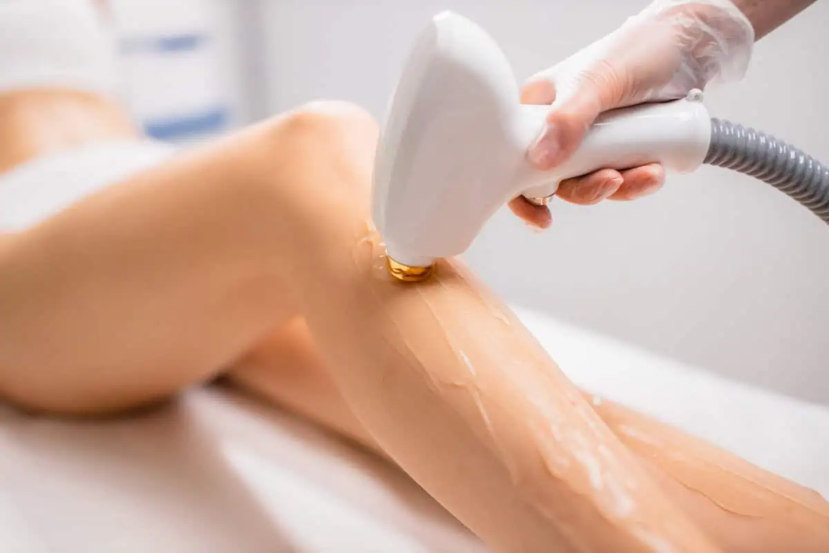 Ultimate Guide to Laser Hair Removal by Empowered Med Spa in Tacoma, WA