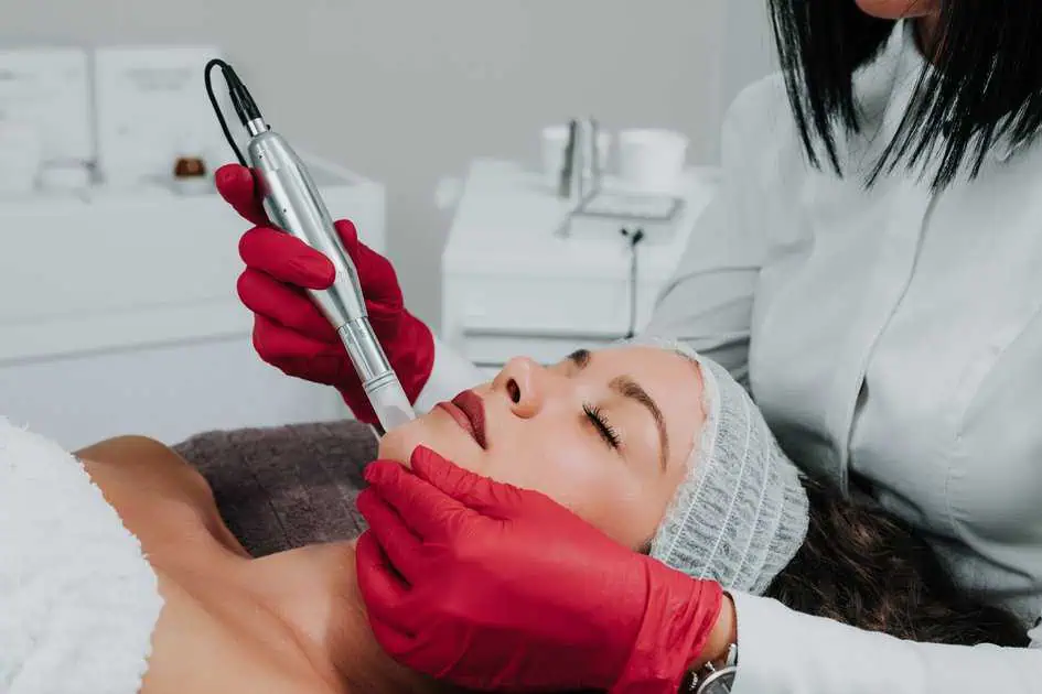 Microneedling treatment in Tacoma WA by Empowered Med Spa