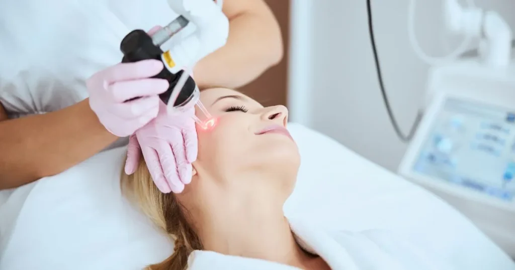 Woman receiving professional laser treatment on her face in Tacoma, WA